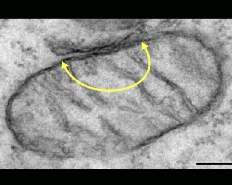 Let’s take a closer look. The electron micrograph shows an interaction between ER and mitochondria.