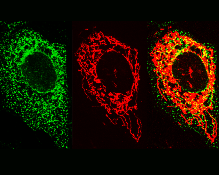 Check out these images taken by a super-resolution microscope. ER (green) + mitochondria (red) = their co-localisation in yellow.