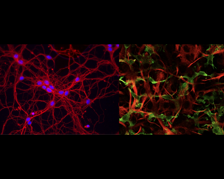 In the lab we culture neurons (left) and glia cells (right) including microglia (green) and astrocytes (red). Microglia are resident innate immune cells of the CNS. This tools are helping us to understand how neuroinflammation impacts neurodegeneration.